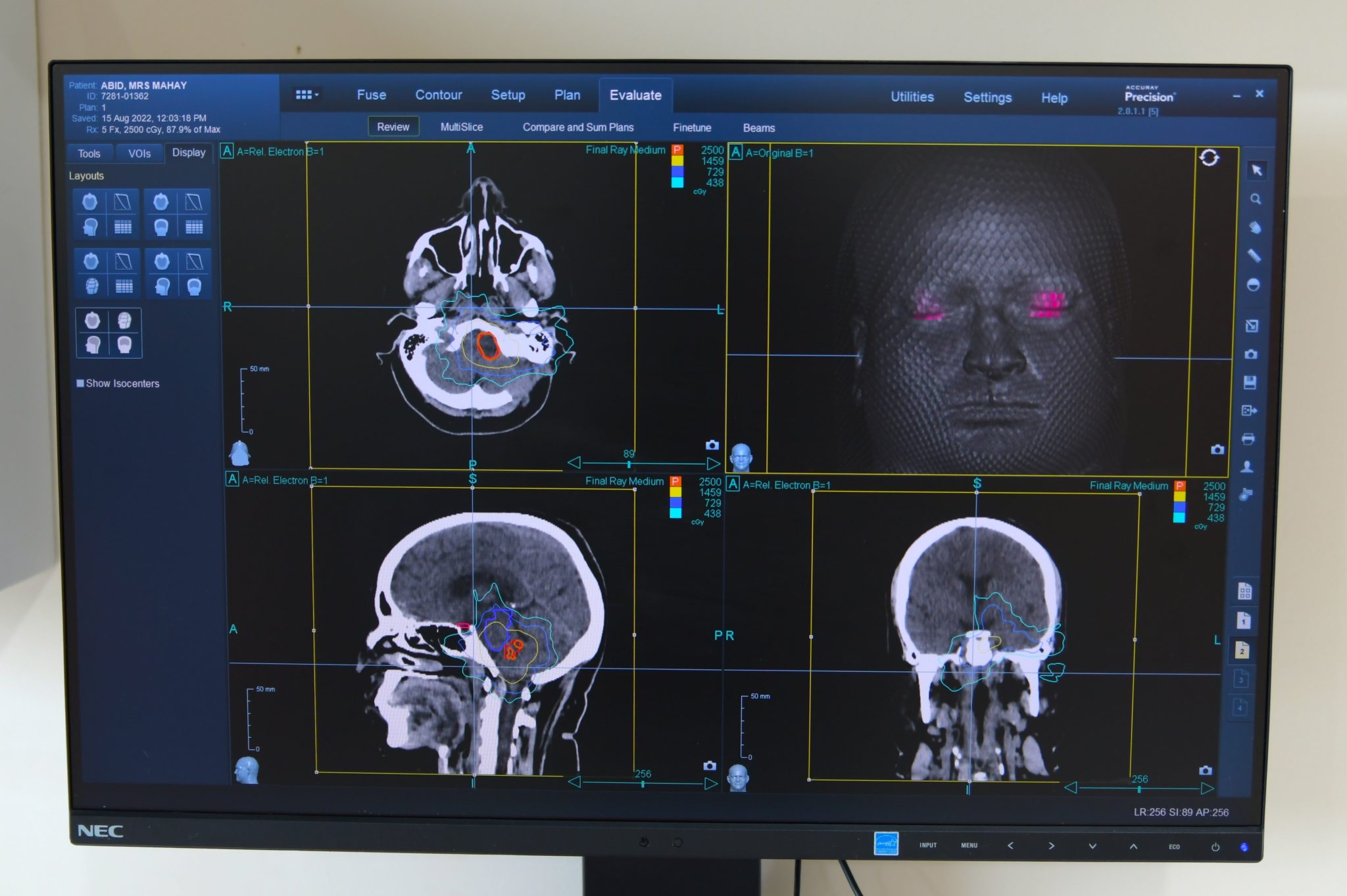 Pakistan 2nd Cyberknife Robotic Radio Surgery System